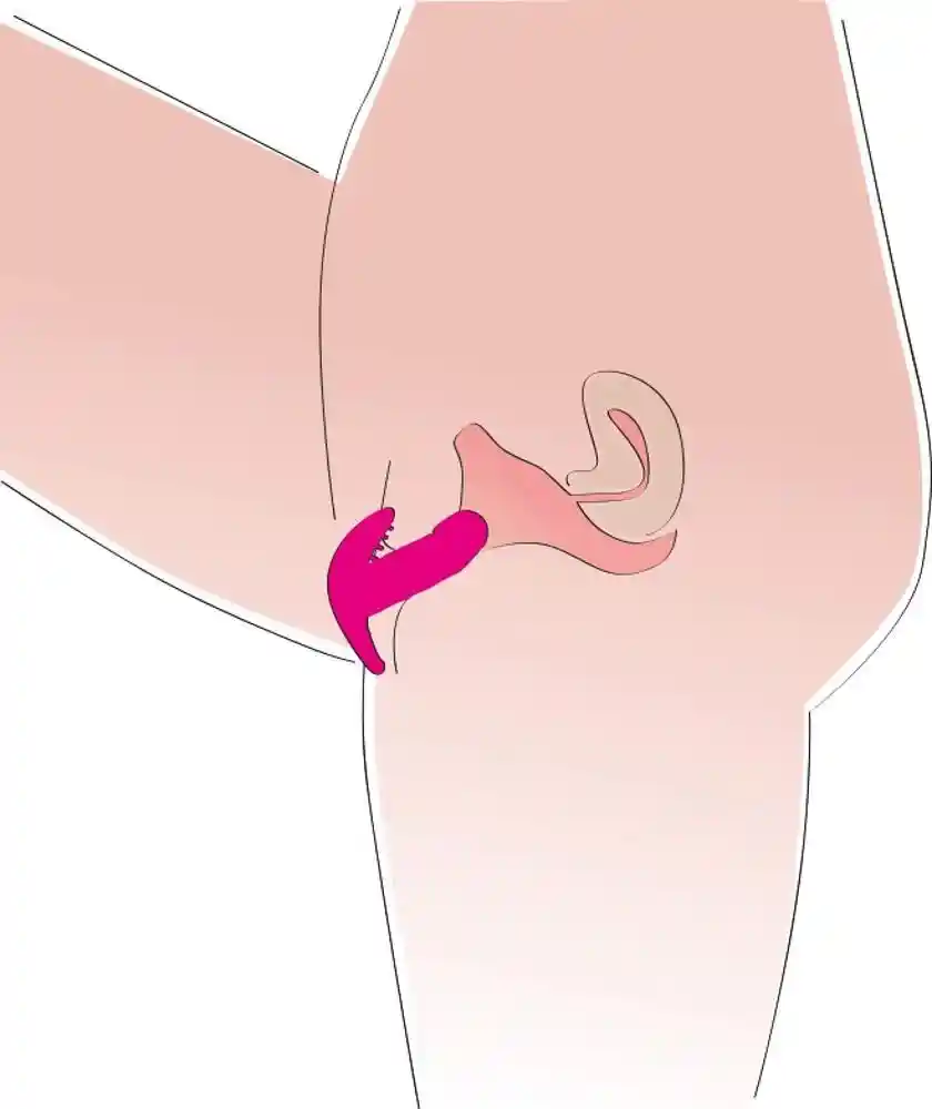 My little secret silicone - obrazek 8